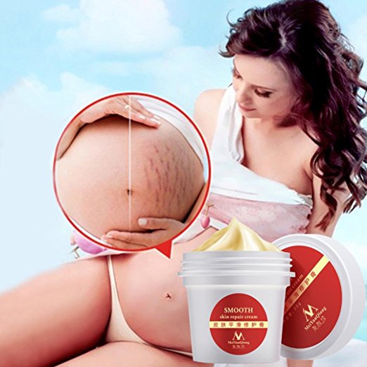 Postpartum Stretch Marks Remover Cream