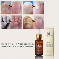 Original Fungal Nail Treatment Essence