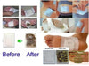 Image of Detox Foot Patches (20 pcs)