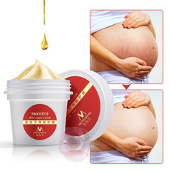 Postpartum Stretch Marks Remover Cream