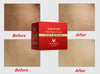 Image of Postpartum Stretch Marks Remover Cream